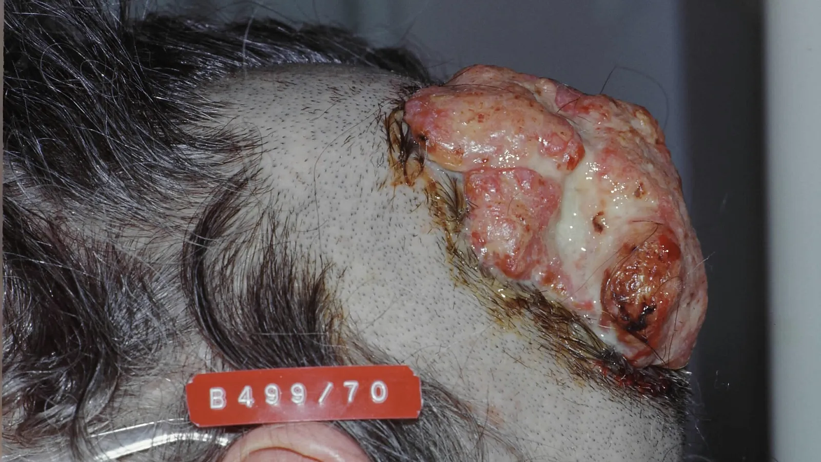 Scalp tattoo melbourne: answers we give most often